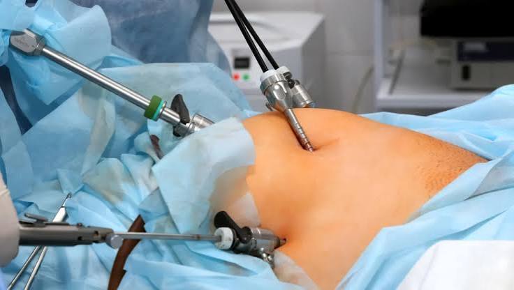 Best Laparoscopic Surgeon in Nagpur