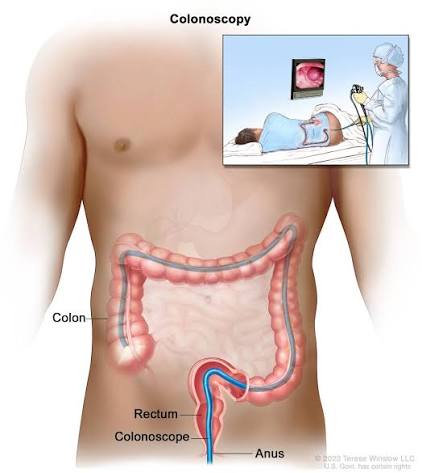 Colonoscopy Doctor in Chhindwara
