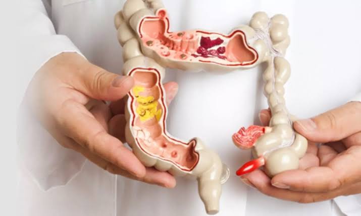 Colorectal Surgeon In Nagpur