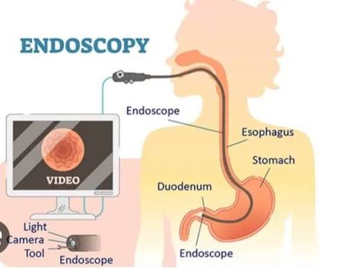 Endoscopy Specialist in Chhindwara