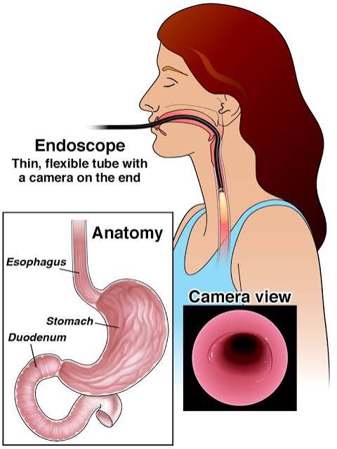 Endoscopy Specialist in Satna