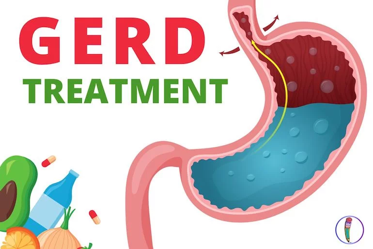 GERD Treatment In Nagpur