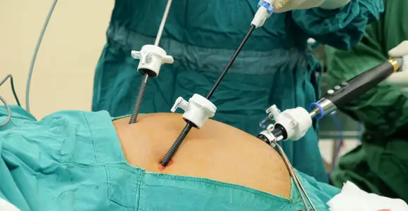Gallbladder Stone Surgery In Nagpur