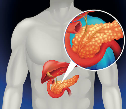 Hepatobiliary Surgery In Nagpur