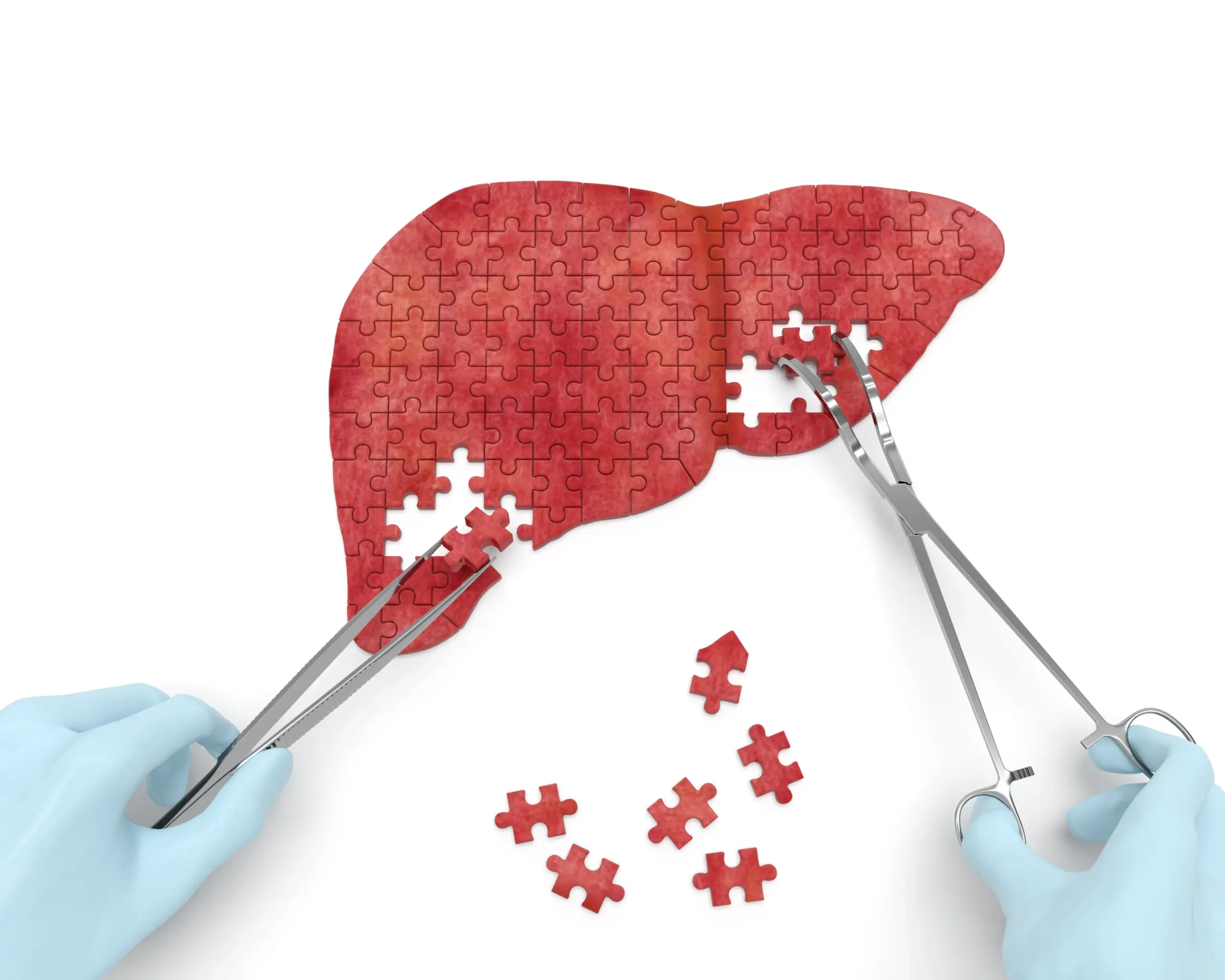 Liver Surgery In Nagpur