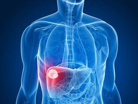 Liver Tumor Surgery In Nagpur