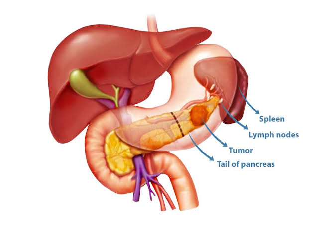 Pancreas Surgery In Nagpur