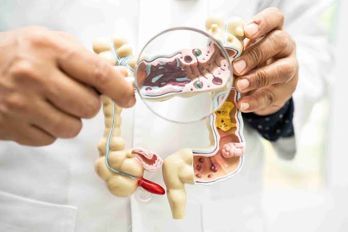 Colonoscopy doctor in chandrapur