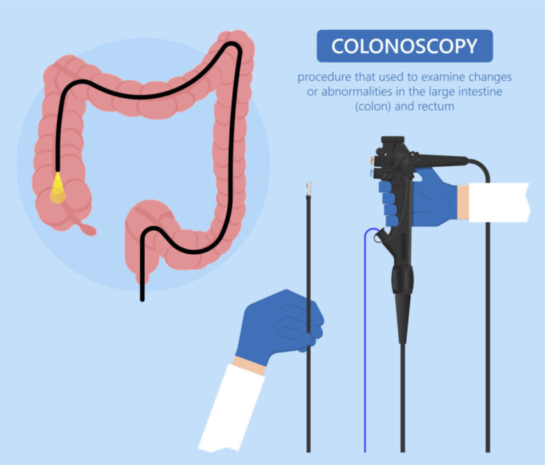 Colonoscopy doctor in gondia