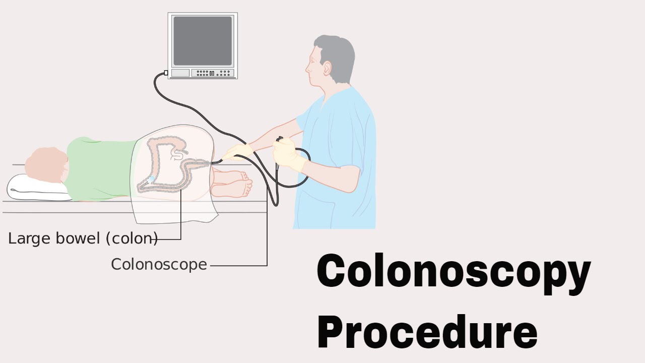 Colonoscopy doctor in katni