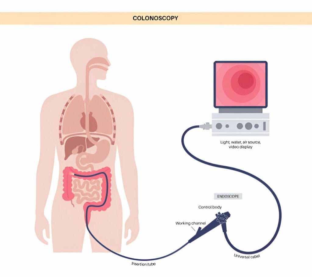 Colonoscopy doctor in sagar