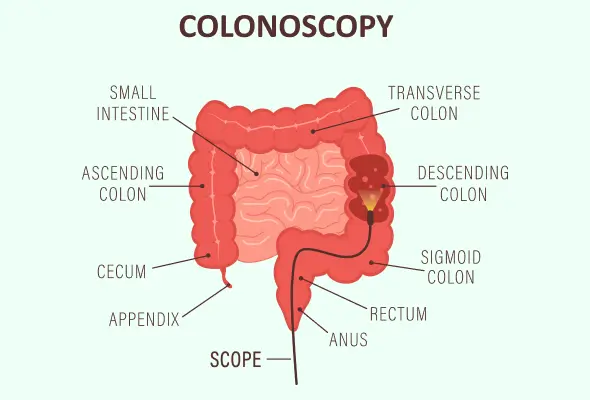 Colonoscopy doctor in yavatmal