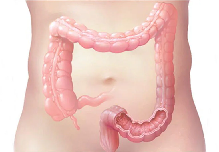 Digestive disease specialist in yavatmal 1