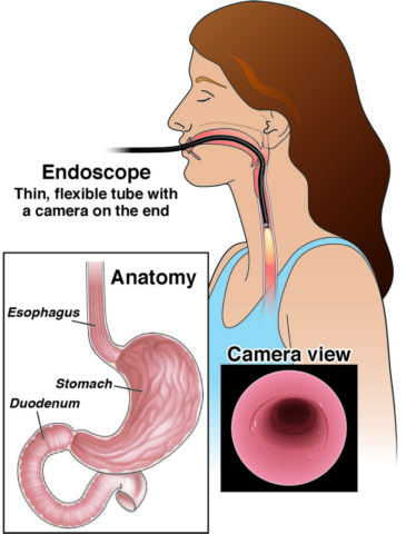 Endoscopy specialist in gadchiroli