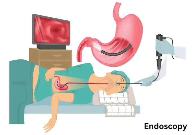 Endoscopy specialist in sagar 1