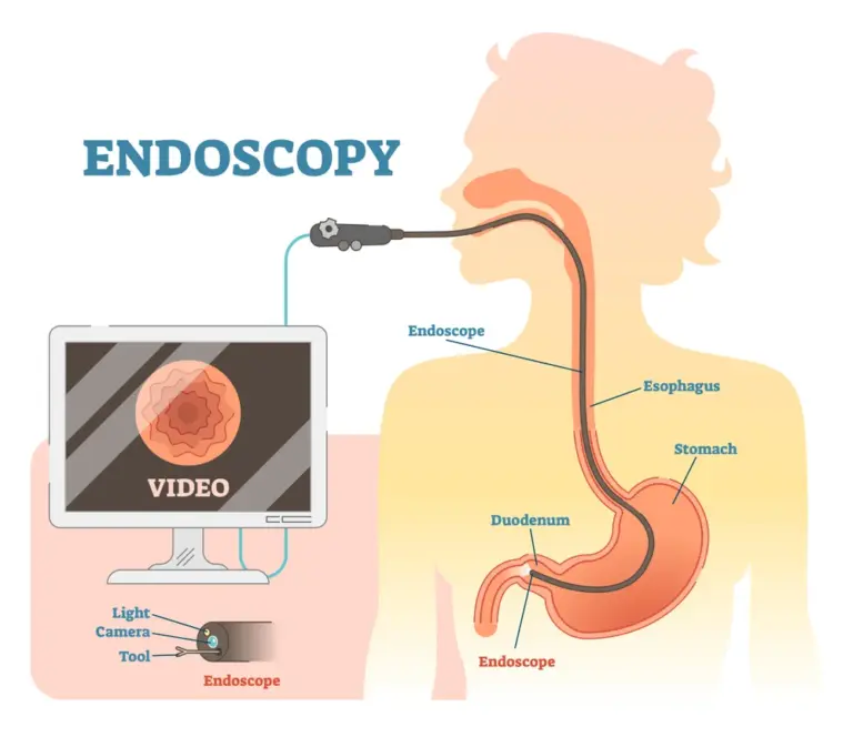 Endoscopy specialist in yavatmal