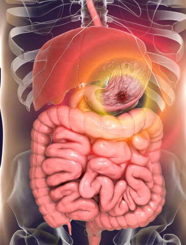 Gastrointestinal Specialist in Yavatmal