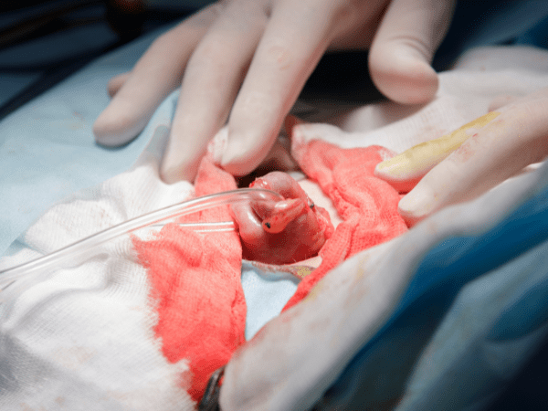 Intestinal surgery