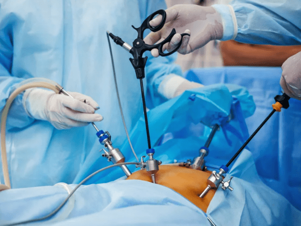 Laparoscopic surgery