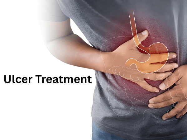 Ulcer Treatment