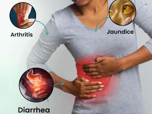 Liver disease treatment